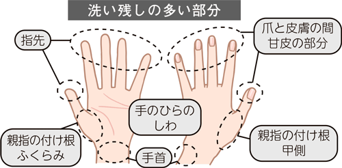 洗い残しの多い部分